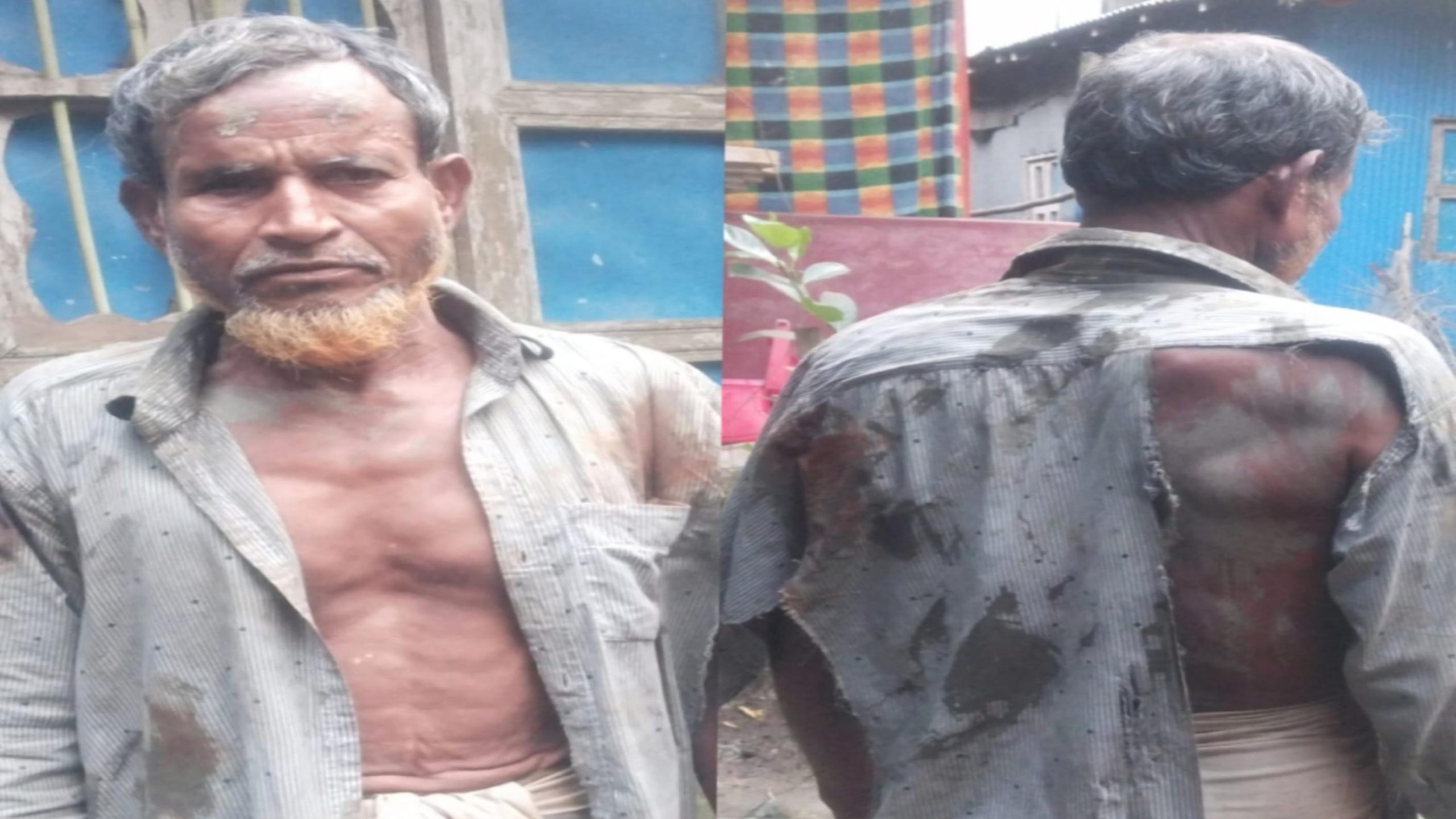 প্রতিবন্ধী বৃদ্ধকে একাধিকবার পিটিয়ে জখম করার অভিযোগ