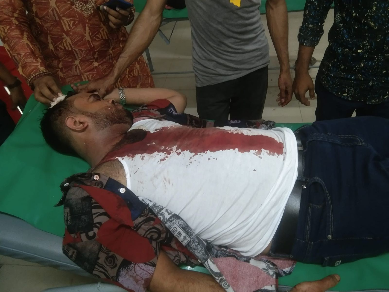 চাঁদা না পেয়ে প্রবাসীকে কুপিয়ে জখম করলেন যুবদল নেতা, মামলা