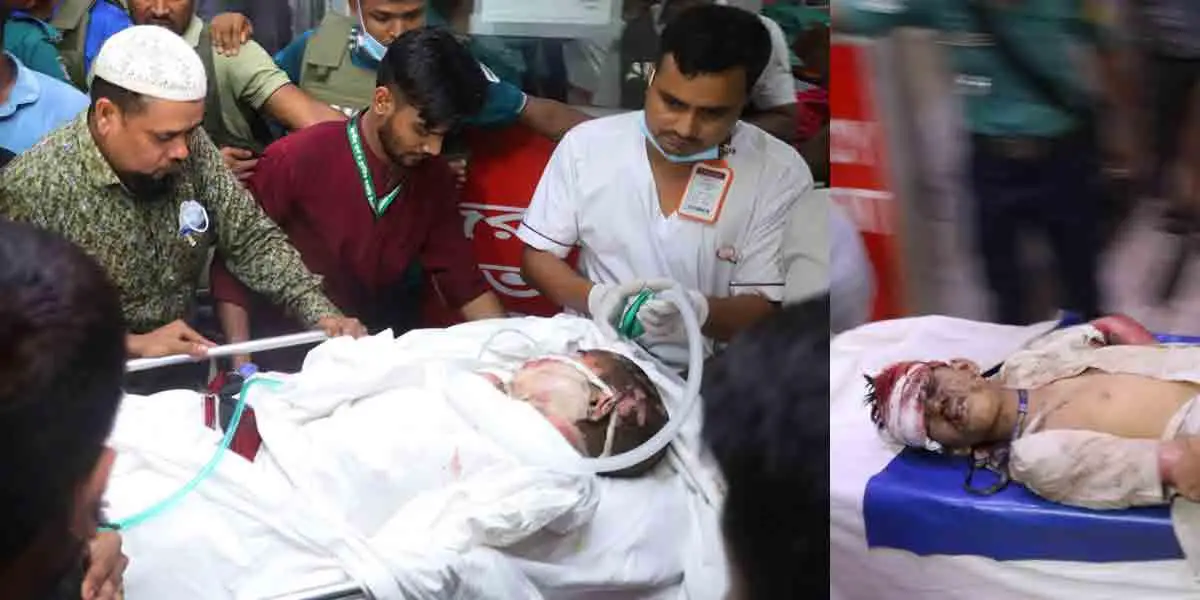 উত্তরায় বিমান বিধ্বস্তে নিহত বেড়ে ২০, চিকিৎসাধীন ১৭১