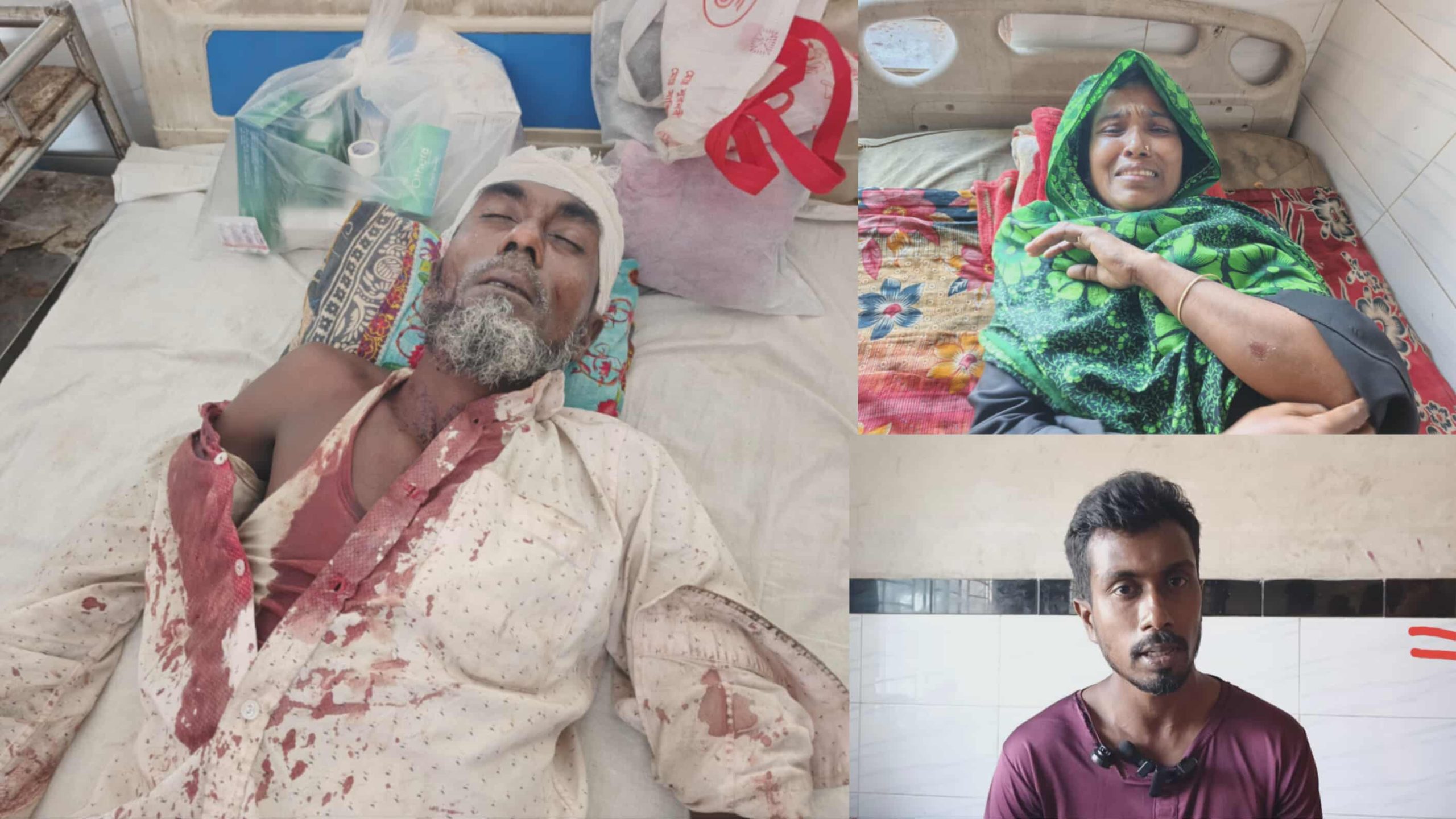 ‎চরফ্যাশনে নারিকেল নিয়ে দ্বন্দ্ব, ভাতিজার দায়ের কোপে রক্তাক্ত চাচা